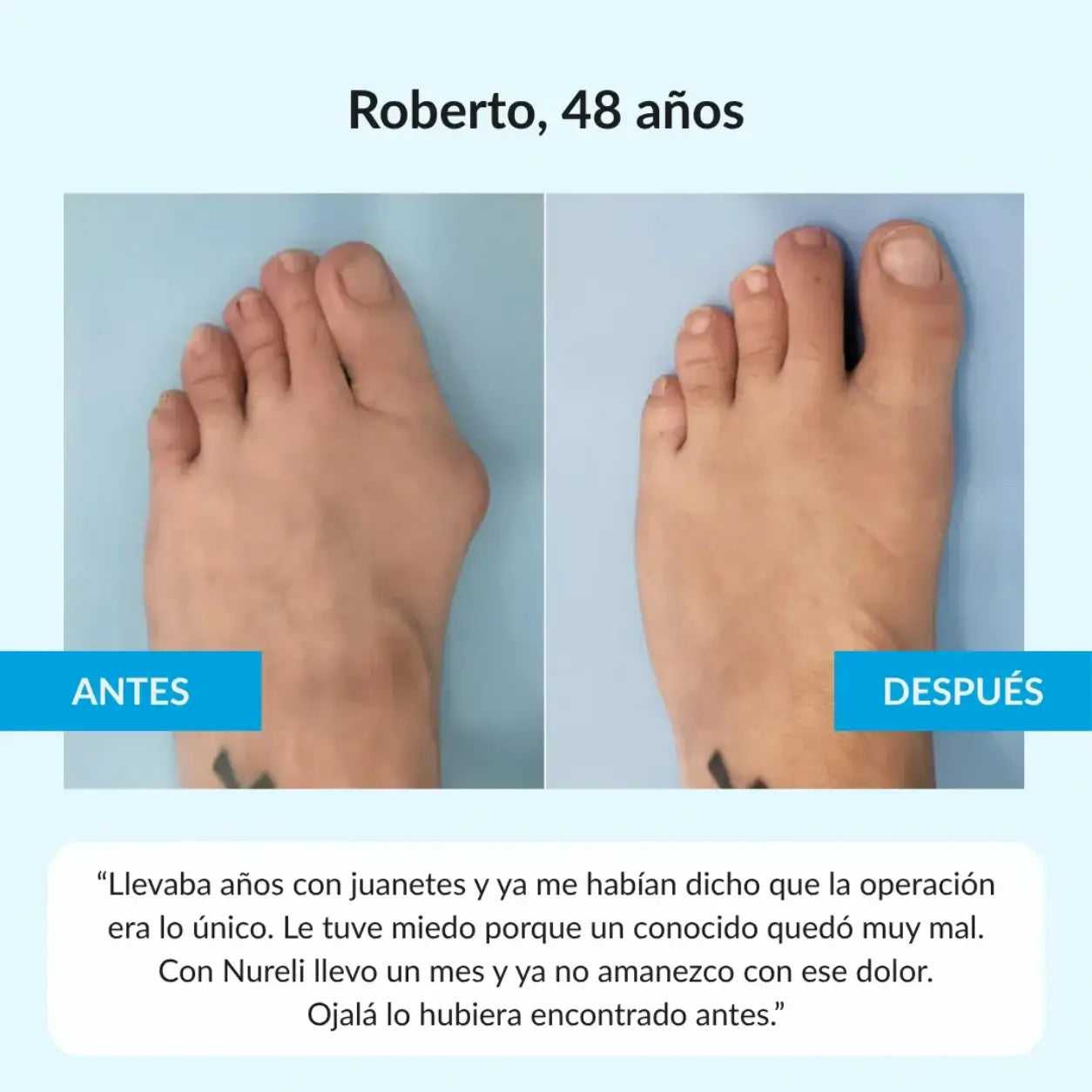 PodoCor - Corrige juanetes mientras haces tu vida normal