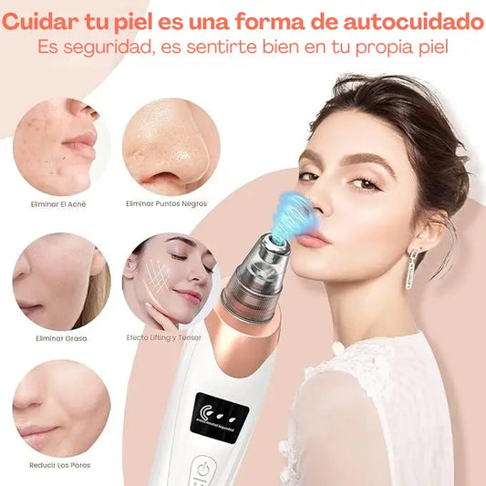 Maquina De Succión Puntos Negros ⚡El secreto de sentirte bien